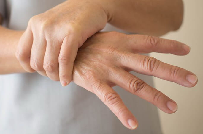 Что такое артрит и как его лечить