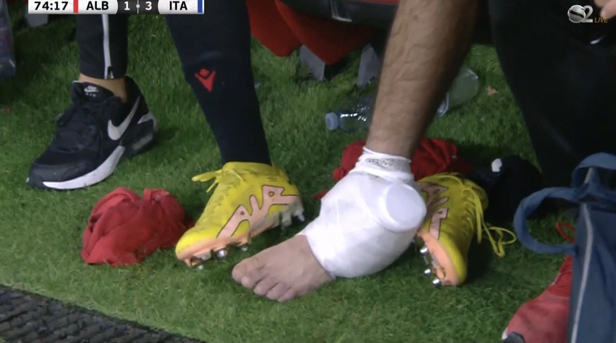 Травма в матче реал. Травма голеностопа у футболистов.