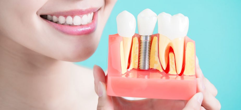 Показания и противопоказания к протезированию зубов