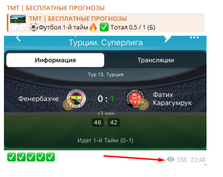 ТМТ бесплатные прогнозы